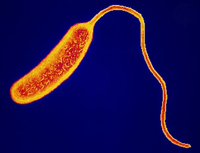 Cholera bacillus