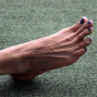get rid of toenail fungus